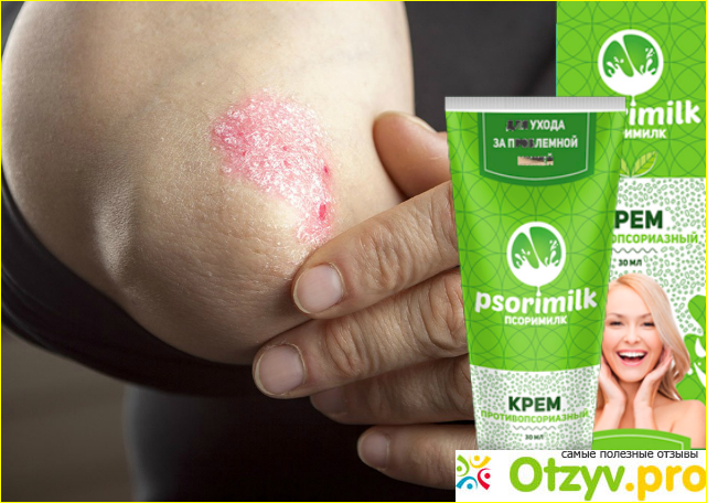 Psorimilk