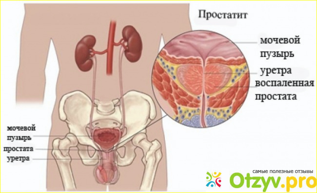 Простодин капли от простатита