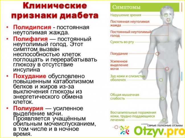 Скрытый диабет симптомы. Сахарный диабет симптомы у мужчин первые признаки 2 типа. Проявления сахарного диабета у мужчин. Симптомы диабета у мужчин после 30. Внешние симптомы диабета 1 типа.