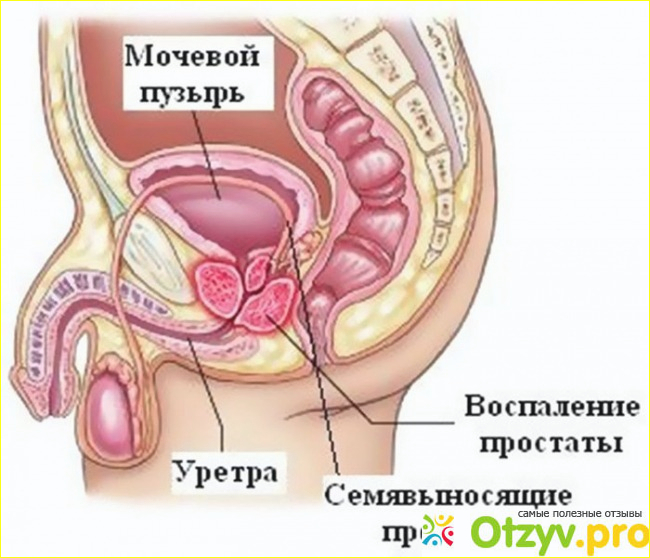 Что же входит в состав препарата: