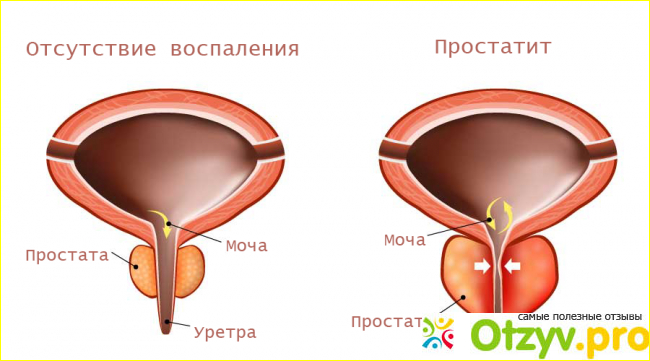 Медовый сбитень - натуральны лекарственный препарат