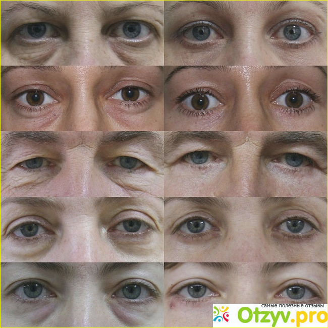 Пластическая хирургия творит чудеса