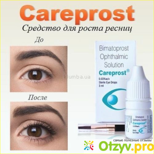 Отзыв о Карепрост careprost отзывы,