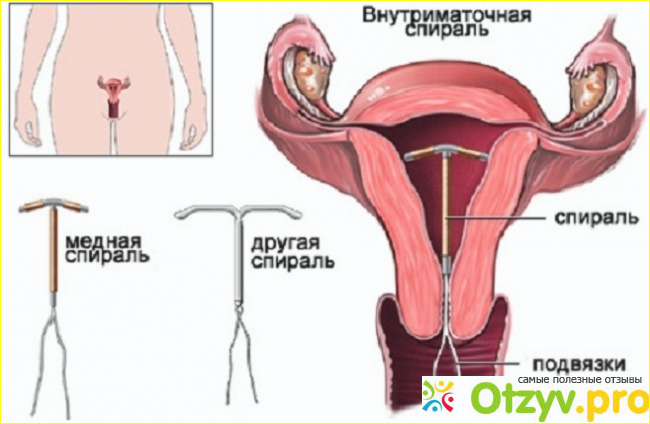 Противопоказания