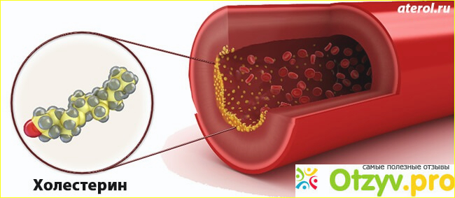 Состав средства от холестерина