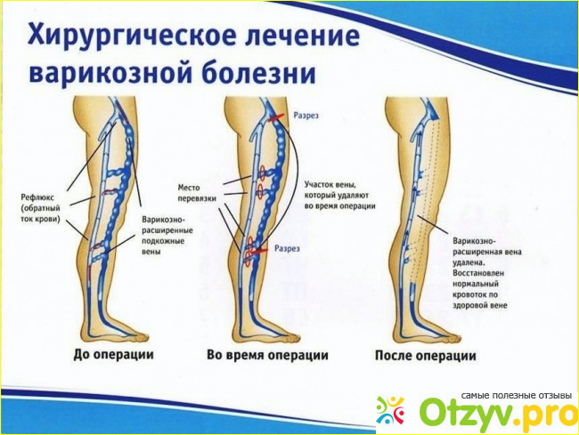 Как лечить советы Форумчан