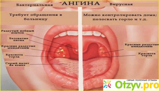 Какие побочные явления могут быть после приёма препарата: