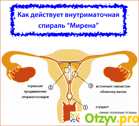 3. Противоречивые мнения женщин