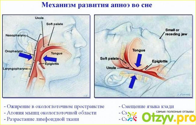 Одним страхом больше...