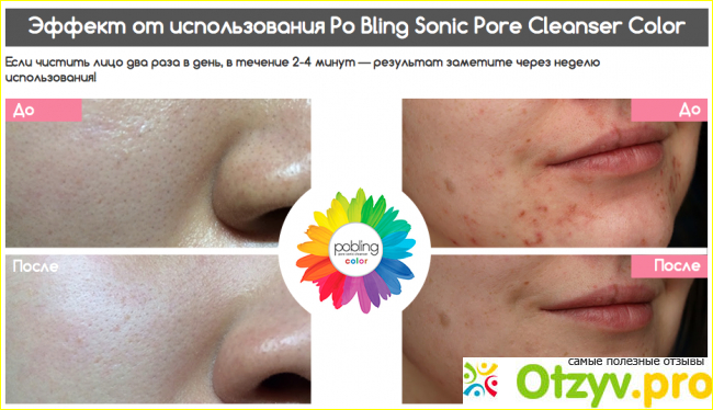 Отзыв о Pobling sonic pore cleansing brush