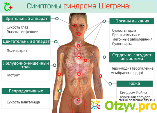 Как вылечить болезнь Шегрена