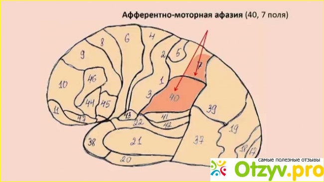 Лечения симптомов афазии при помощи «Нейробутала»