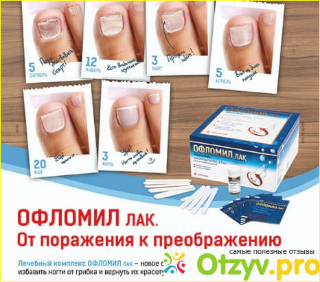 Отзывы про офломил лак