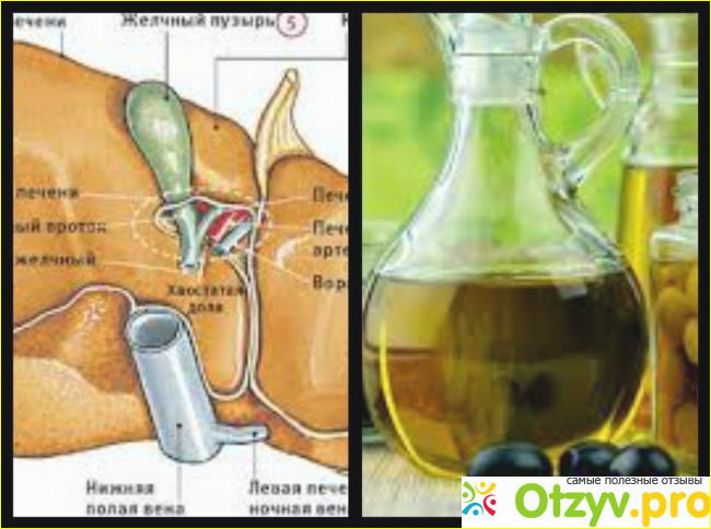 Отзыв о Чистка печени оливковым маслом