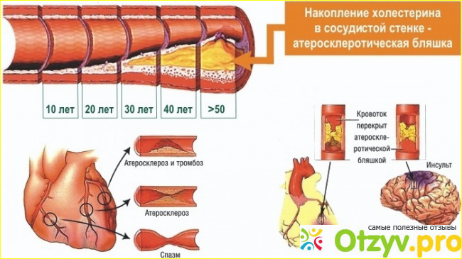 Отзыв о Дуплексное сканирование сосудов головы и шеи: цена