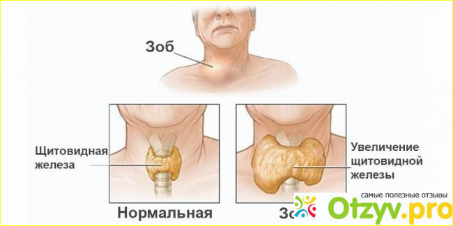 Отзыв о Щитовидная железа: симптомы заболевания у мужчин