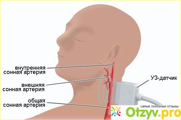 Отзыв о Как проверить сосуды головного мозга и шеи