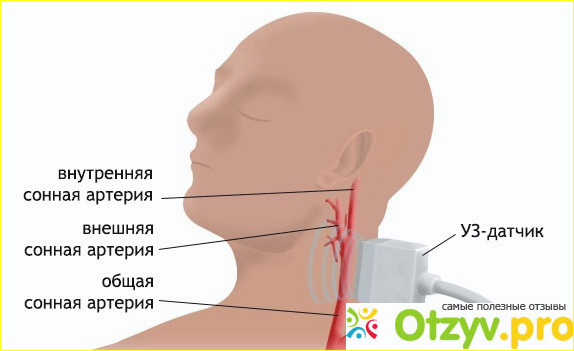 Дуплексное сканирование сосудов головы и шеи: цена фото1