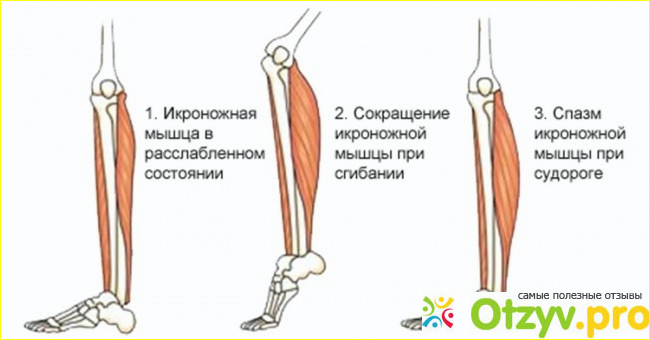 1. Неприятный и болезненный симптом