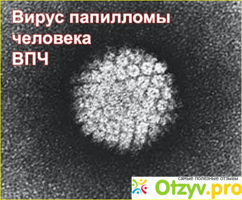 Вирус папилломы человека у женщин в гинекологии фото1