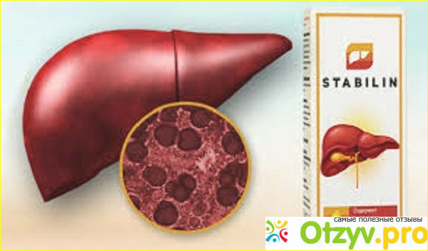 Как правильно принимать препарат Стабилин?