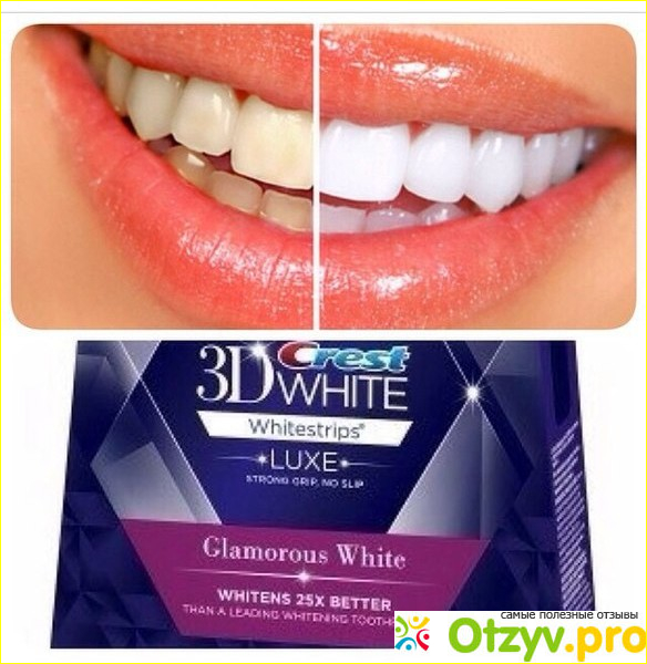 Отзыв о Crest 3D White: цена, отзывы, купить