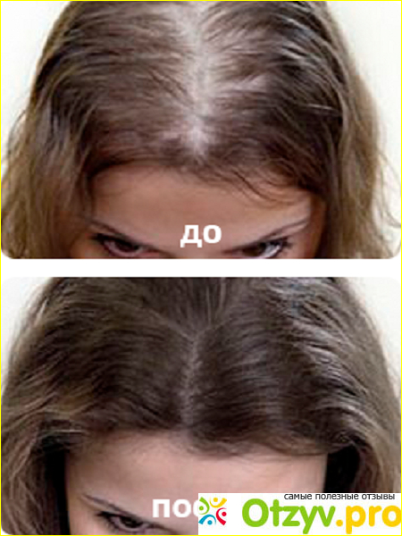 Насколько эффективен Hairish: отзывы специалистов