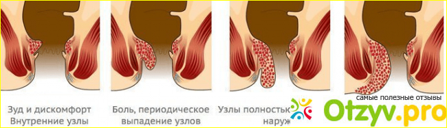 Инструкция по применению