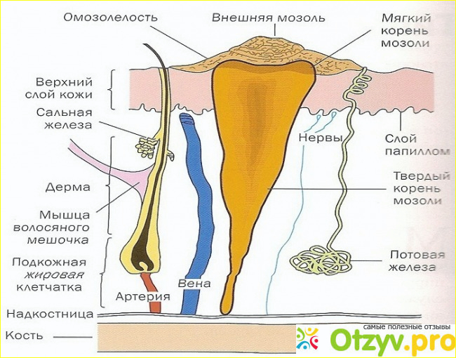 Причины и места