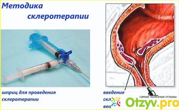 Как проводится процедура