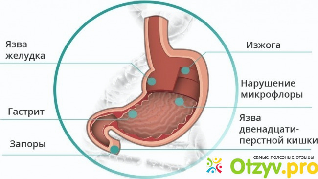 Насколько эффективен Gastrenit: отзывы врачей
