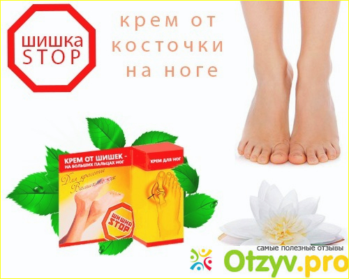 Преимущества лечения кремом Шишка Стоп.