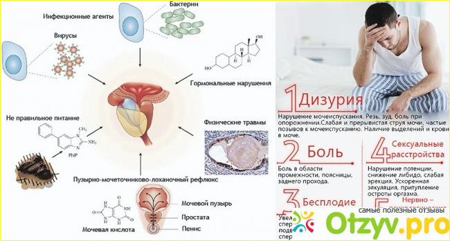 Отзыв о От чего таблетки Урсосан?