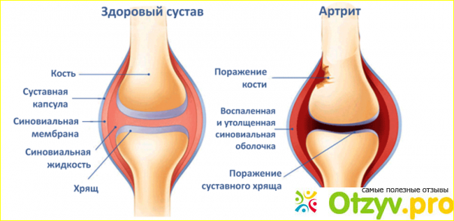 Противопоказания