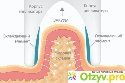 Что это за процедура? 