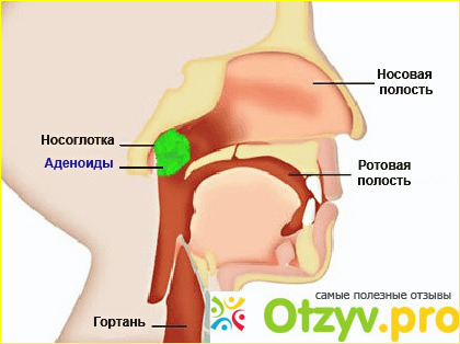 Лечить или удалять?