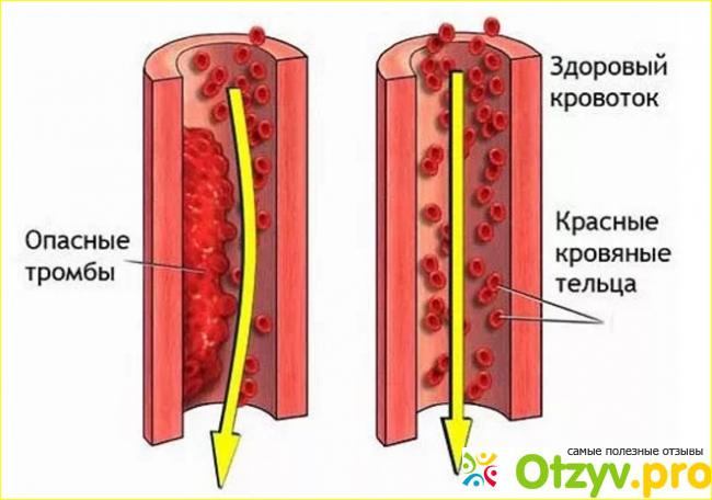 Побочные эффекты.