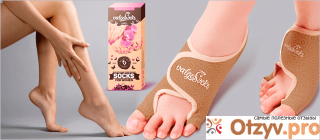 Отзыв о Valgosocks носочки от косточки: цена, отзывы, купить