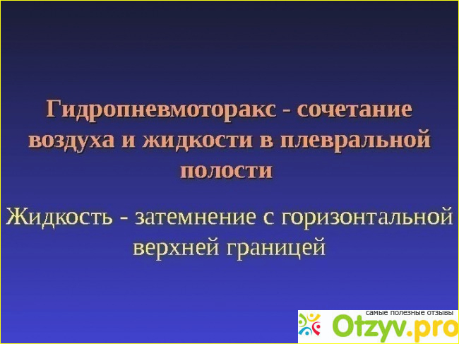 Что со мной произошло в тот злосчастный день