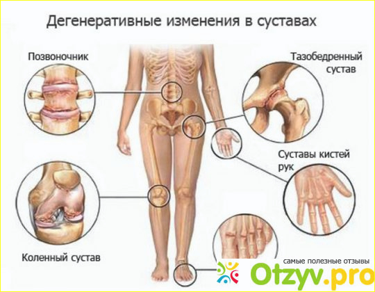 Румалон отзывы больных применяющих этот препарат