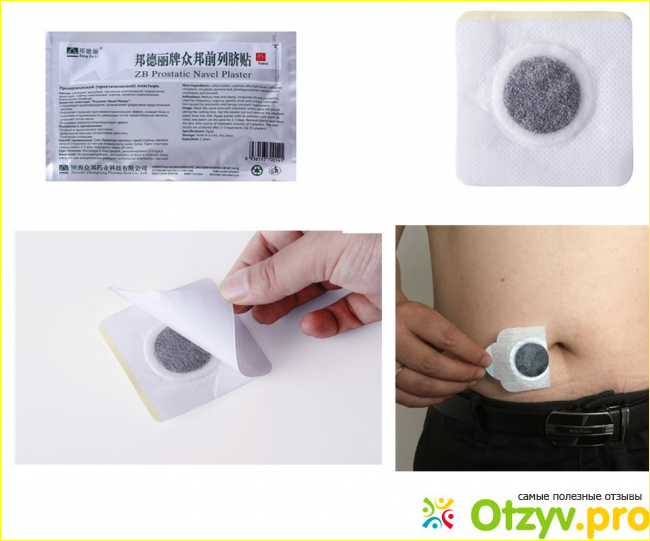 Урологический пластырь «ZB PROSTATIC NAVEL PLASTER» - липкий лохотрон?!