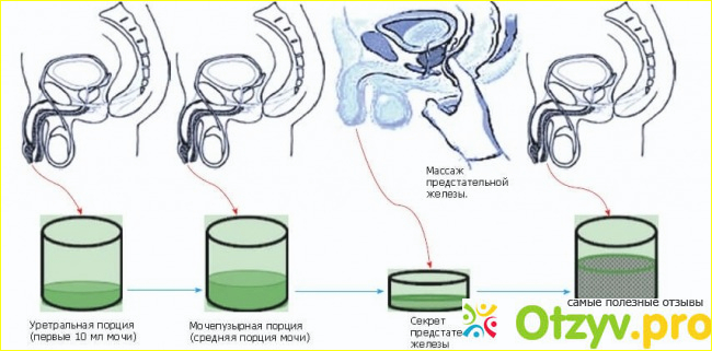 Ужасный врач-уролог