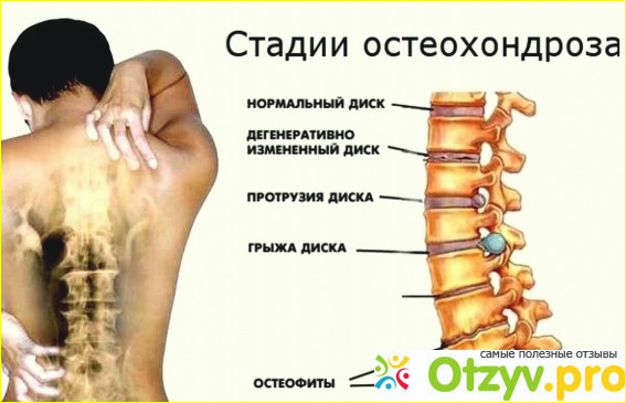 Процедуры растягивались как могли