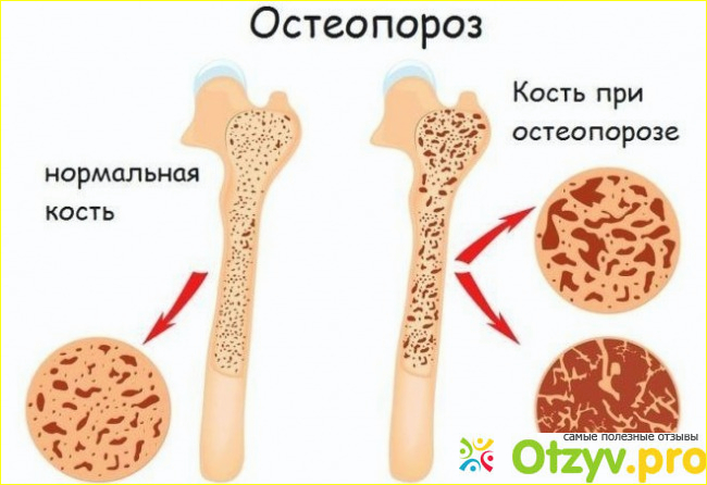 Пролиа, что он представляет из себя.