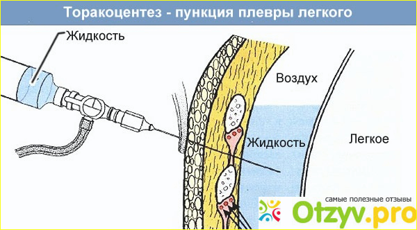 Побывал я в городе невест не удачно