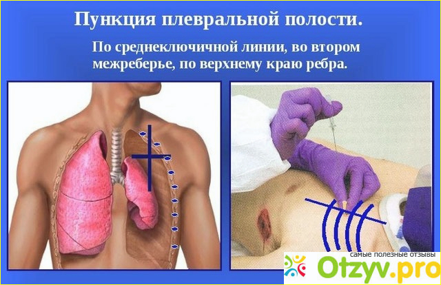 Поездка в Армению и знакомство с врачом Арамом Ашотовичем