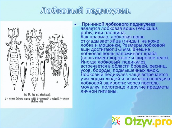 Лобковые вши латынь. Лобковый педикулез симптомы.