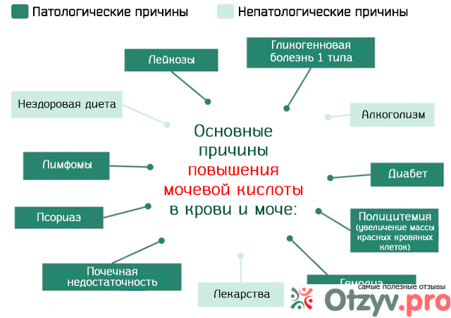 К чему ведет избыток мочевой кислоты