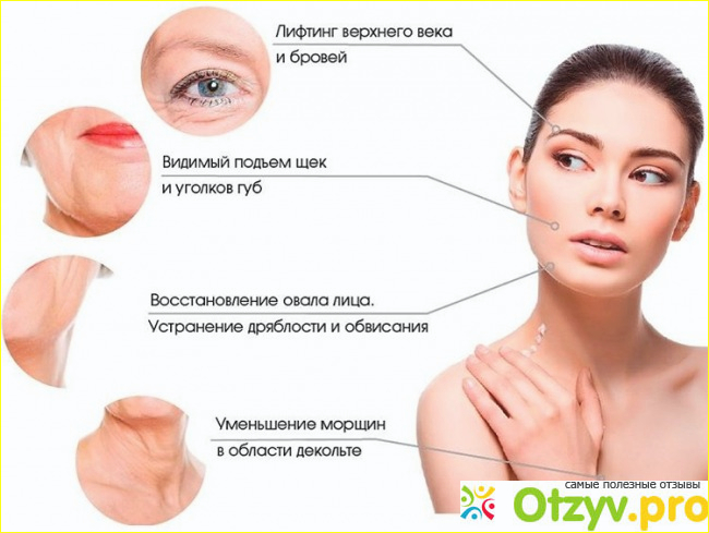 Ulthera system отзывы отрицательные