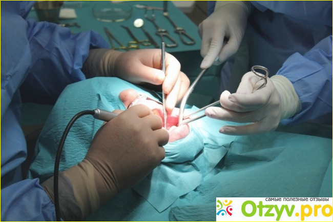 Отзыв о Одноэтапная имплантация зубов отзывы отрицательные
